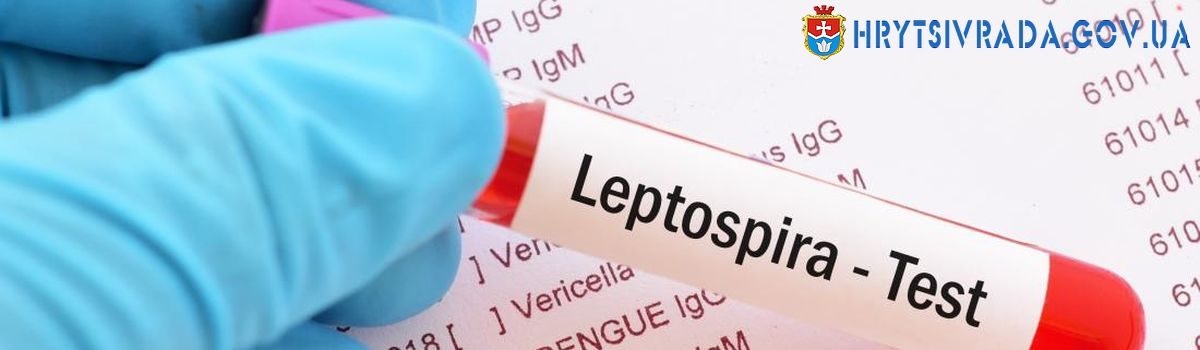 Лептоспіроз – небезпечна хвороба для людини і тварин